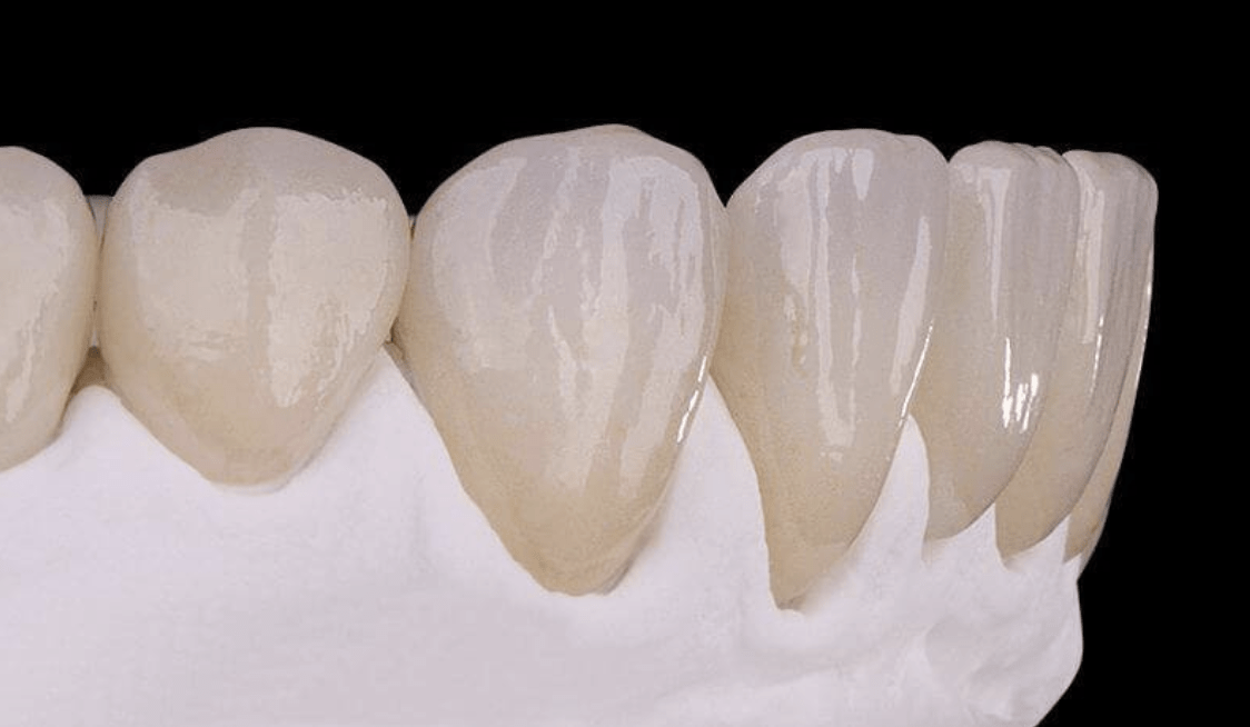 Coroas Dentarias