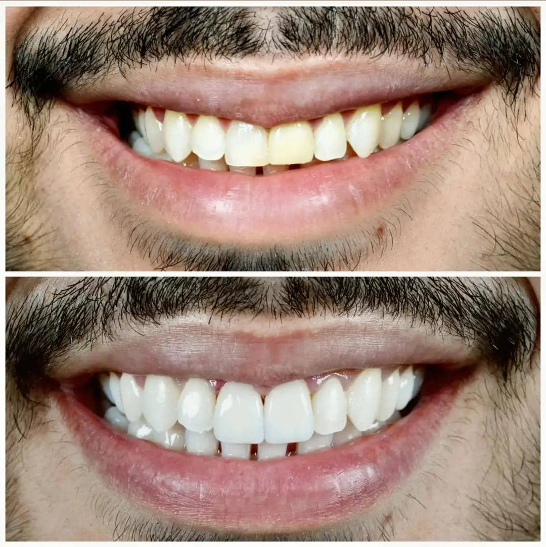 Odonto Liuzzi - Dentista no Flamengo Zona Sul RJ 2